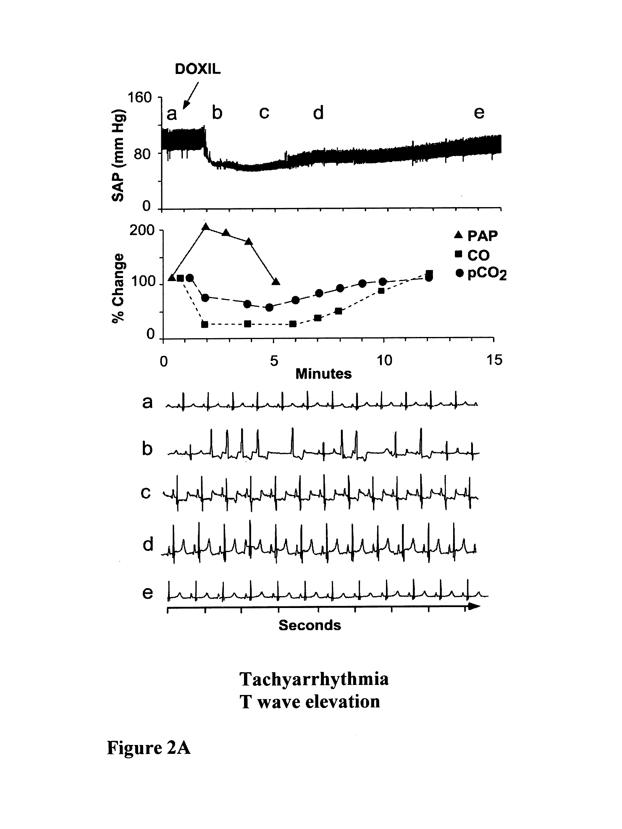 Particulate drug carriers as desensitizing agents