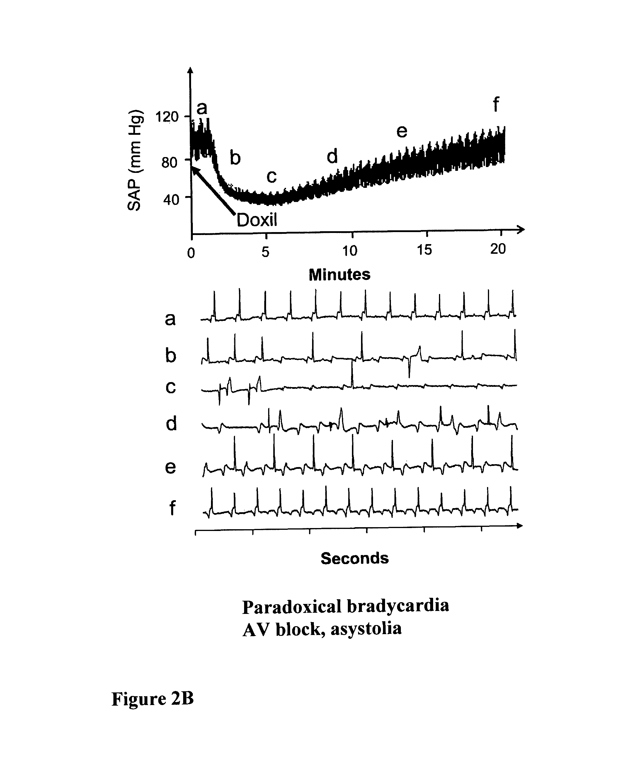 Particulate drug carriers as desensitizing agents