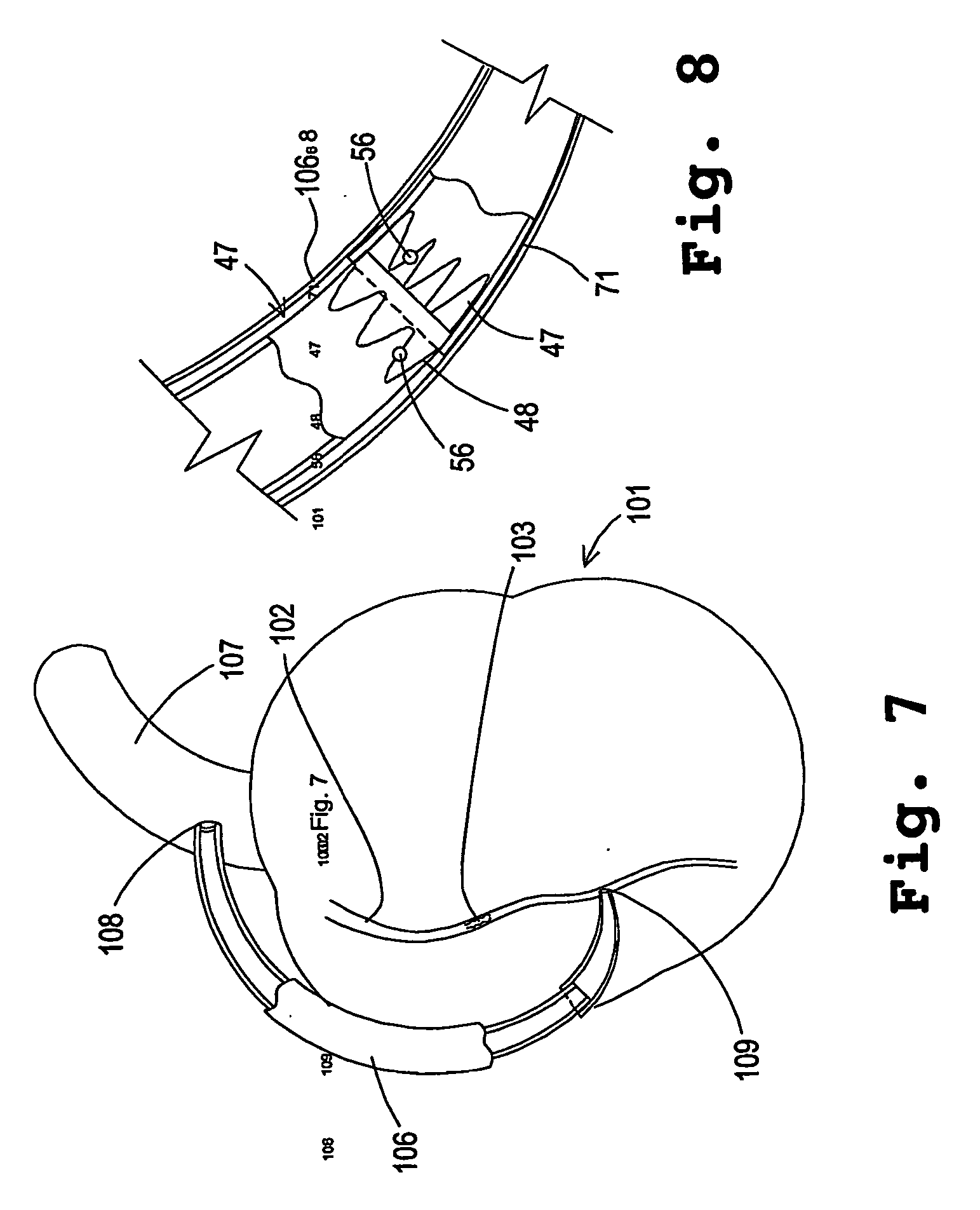 Composite stent with polymeric covering and bioactive coating