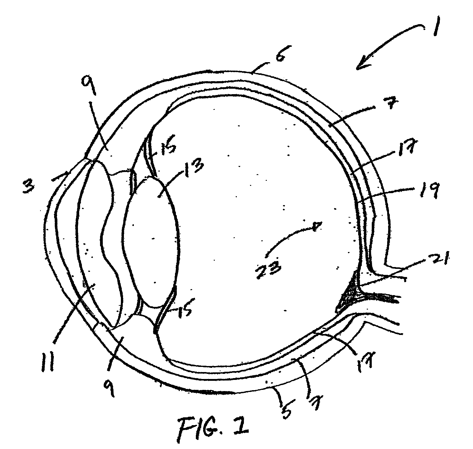 Ophthalmic instrument having adaptive optic subsystem with multiple stage phase compensator