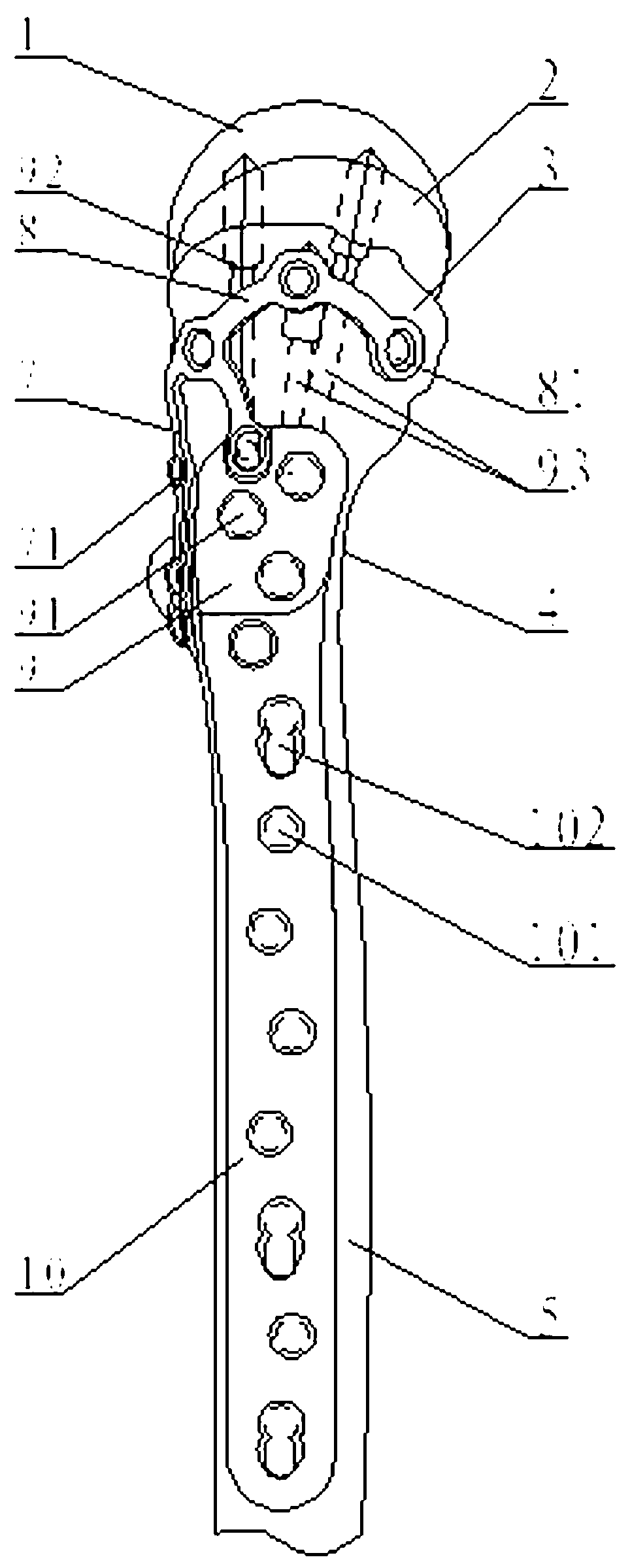 Combined implanting system for minimally invasive thigh bone