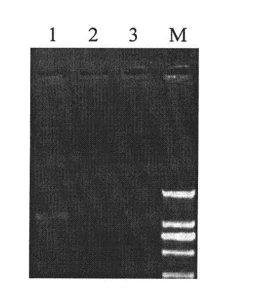 Cotton GbSTK gene, encoding protein thereof and application for resisting verticillium wilt of plants