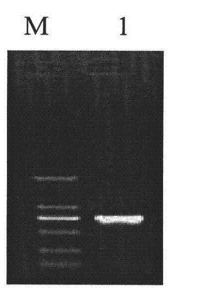 Cotton GbSTK gene, encoding protein thereof and application for resisting verticillium wilt of plants