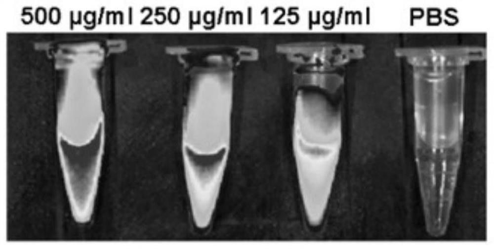 Multifunctional nanoparticles for head and neck squamous cell carcinoma targeted treatment and preparation method