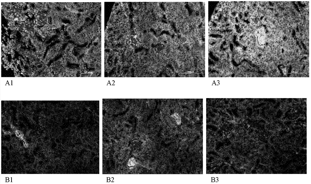 Application of vanillic acid glucoside derivative in treatment of systemic autoimmune disease