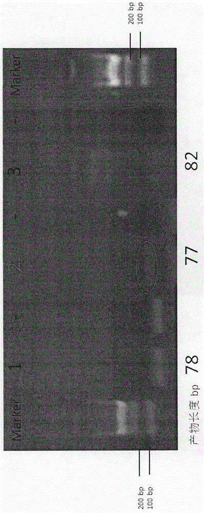 Esophageal carcinoma (EC) diagnosis marker and application method thereof