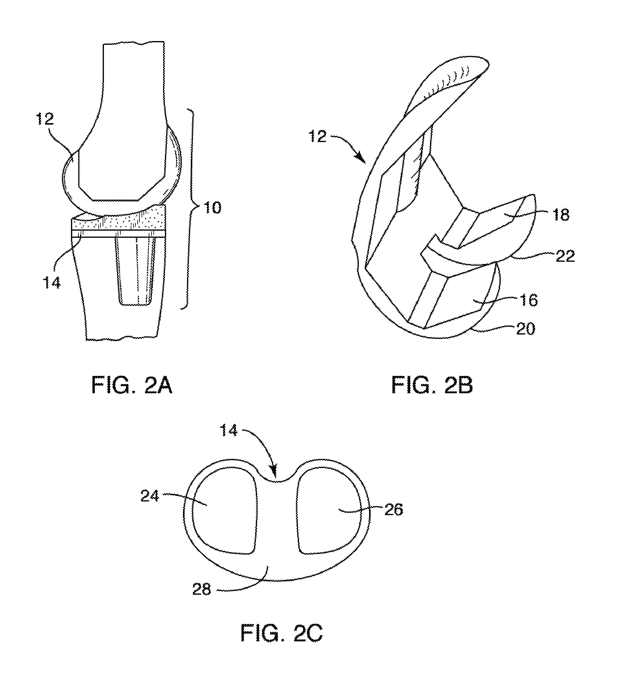 Systems and methods for providing prosthetic components
