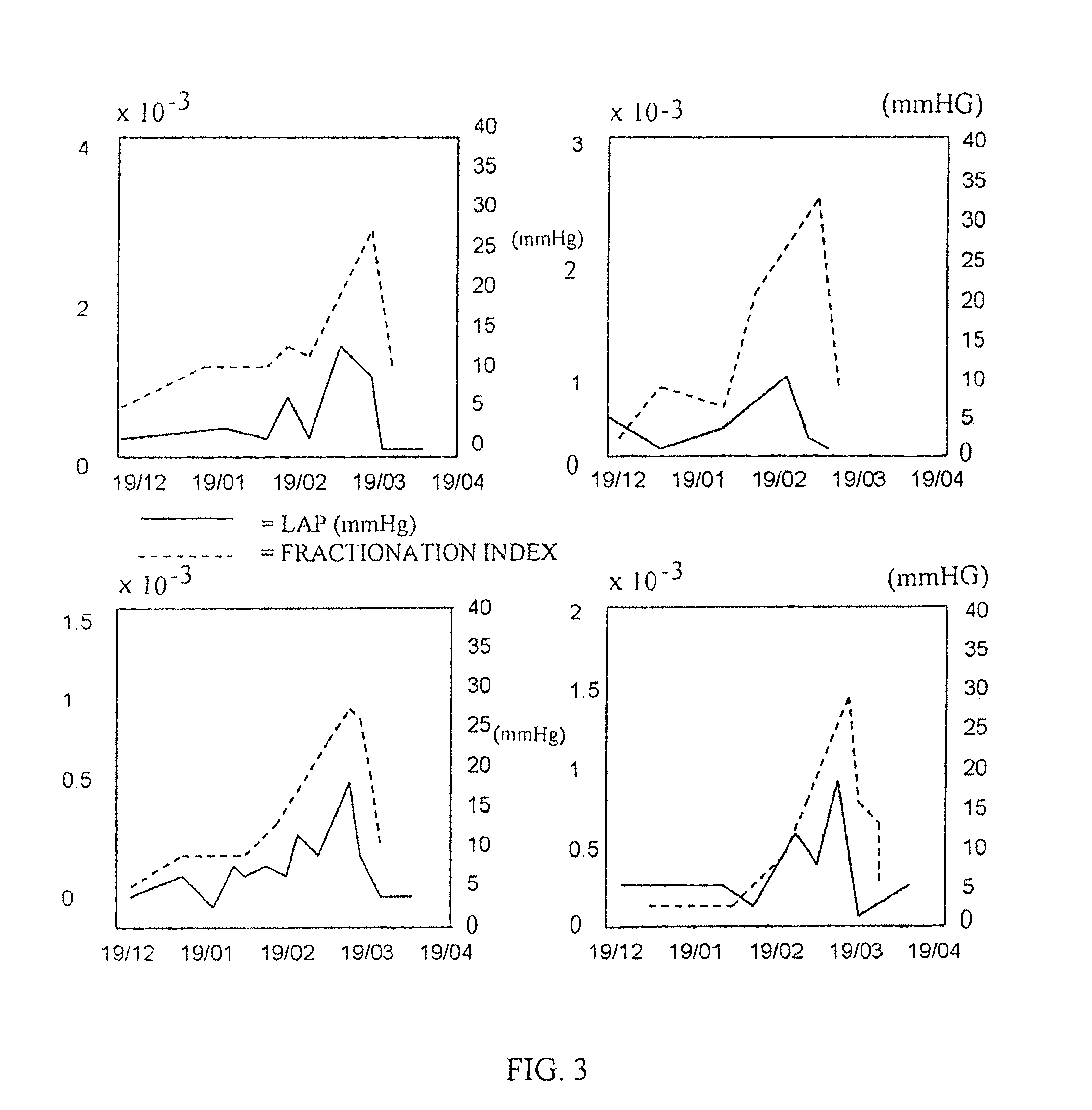 Implantable heart stimulator for measuring dyssynchrony using impedance