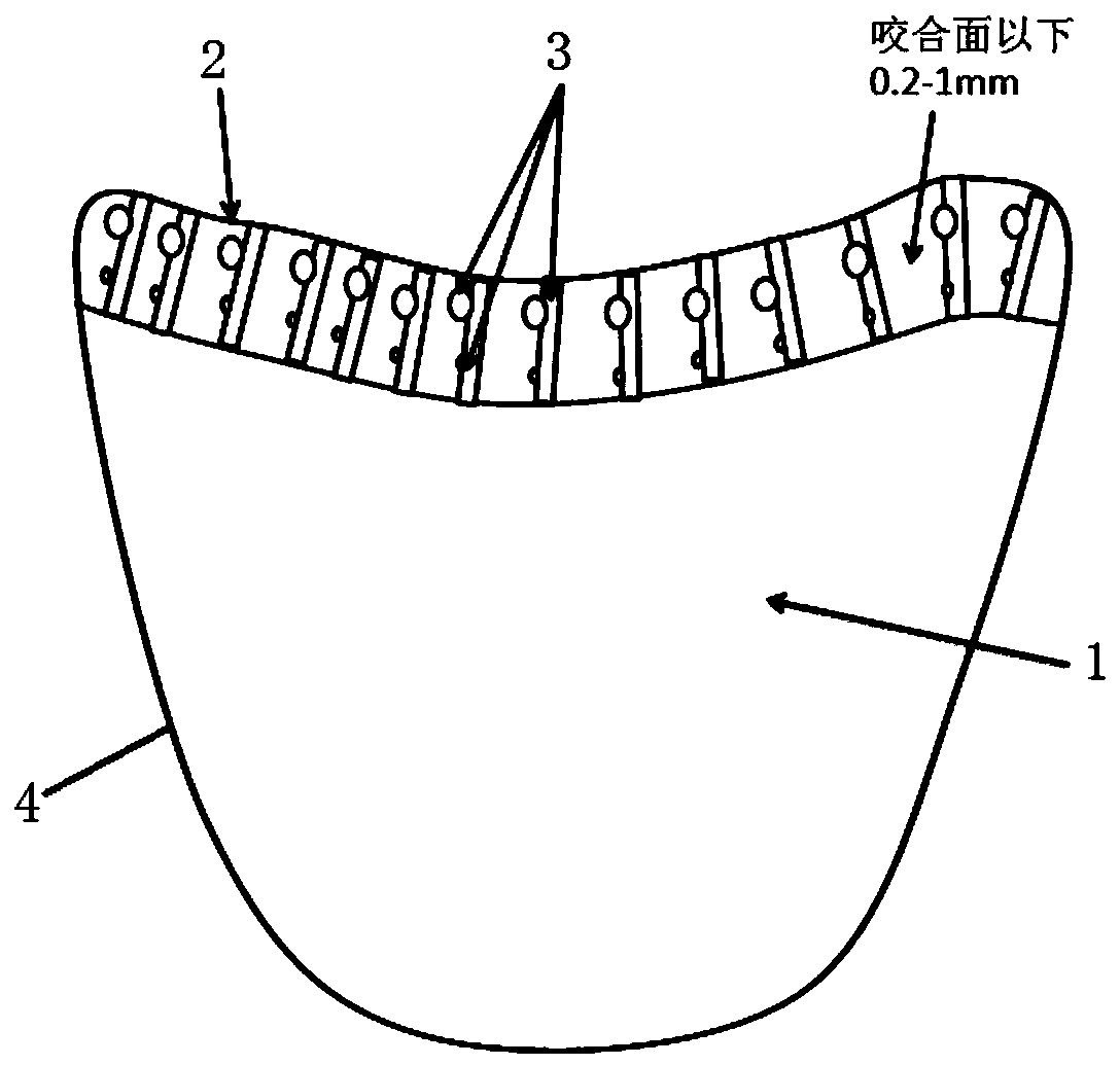 A zirconia denture with gradient mechanical properties and its manufacturing method