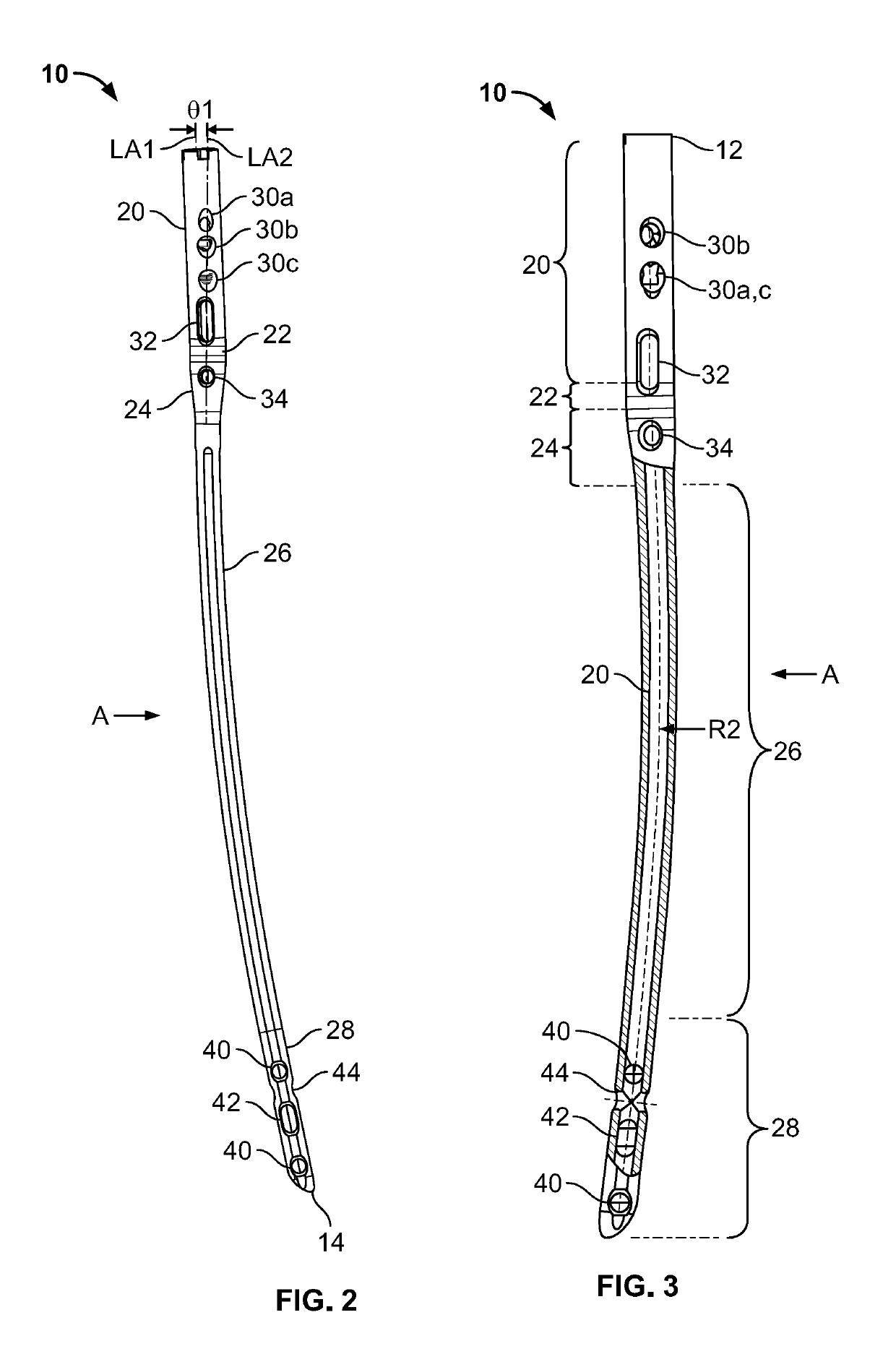 Femoral Nail With Enhanced Bone Conforming Geometry