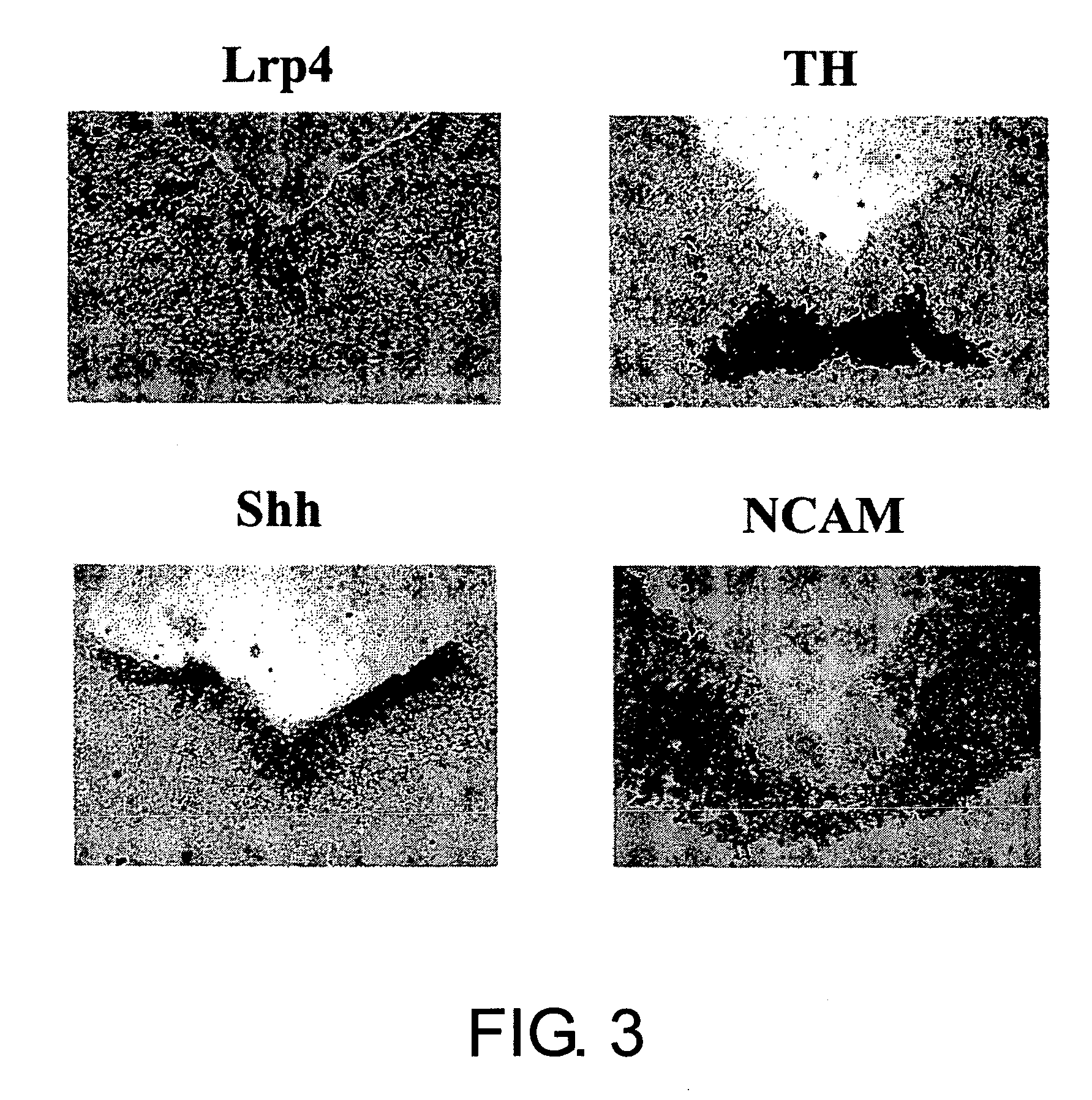 Lrp4/corin dopamine-producing neuron proliferation precursor cell marker