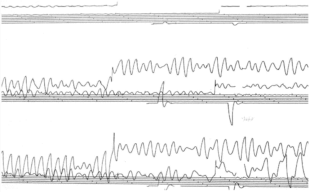 An automatic tracking method of historical seismogram waveform