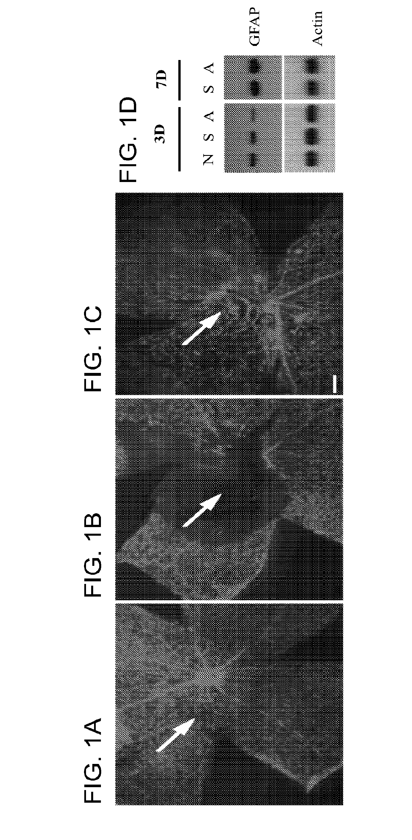 Alpha-Aminoadipate For Treatment Of Vision Loss And Restoring Sight