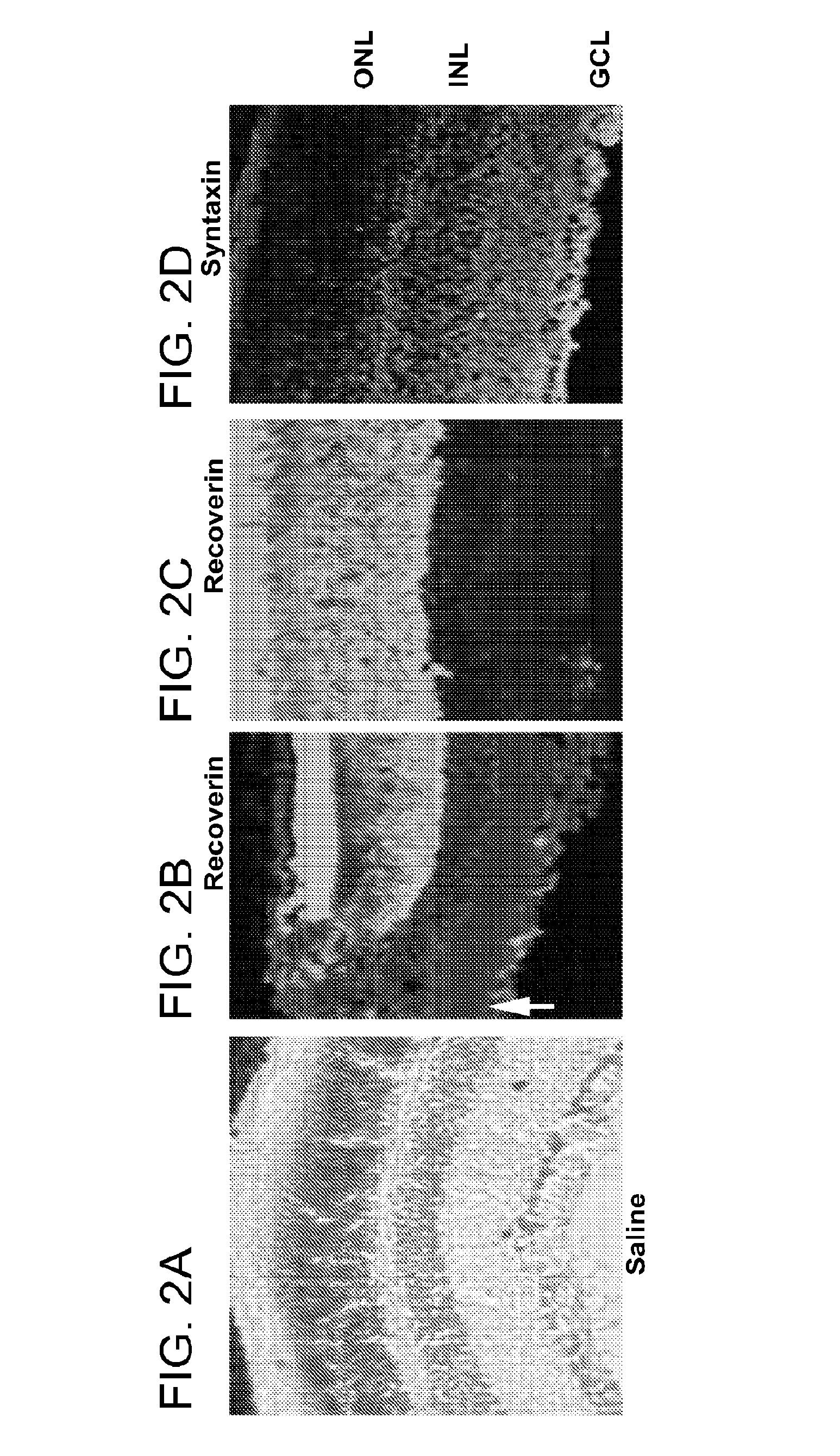 Alpha-Aminoadipate For Treatment Of Vision Loss And Restoring Sight