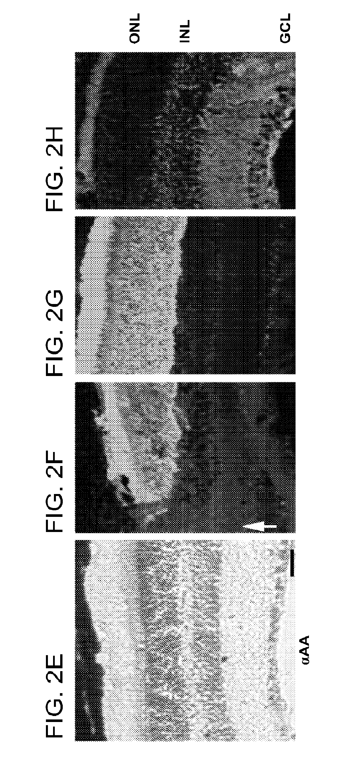 Alpha-Aminoadipate For Treatment Of Vision Loss And Restoring Sight