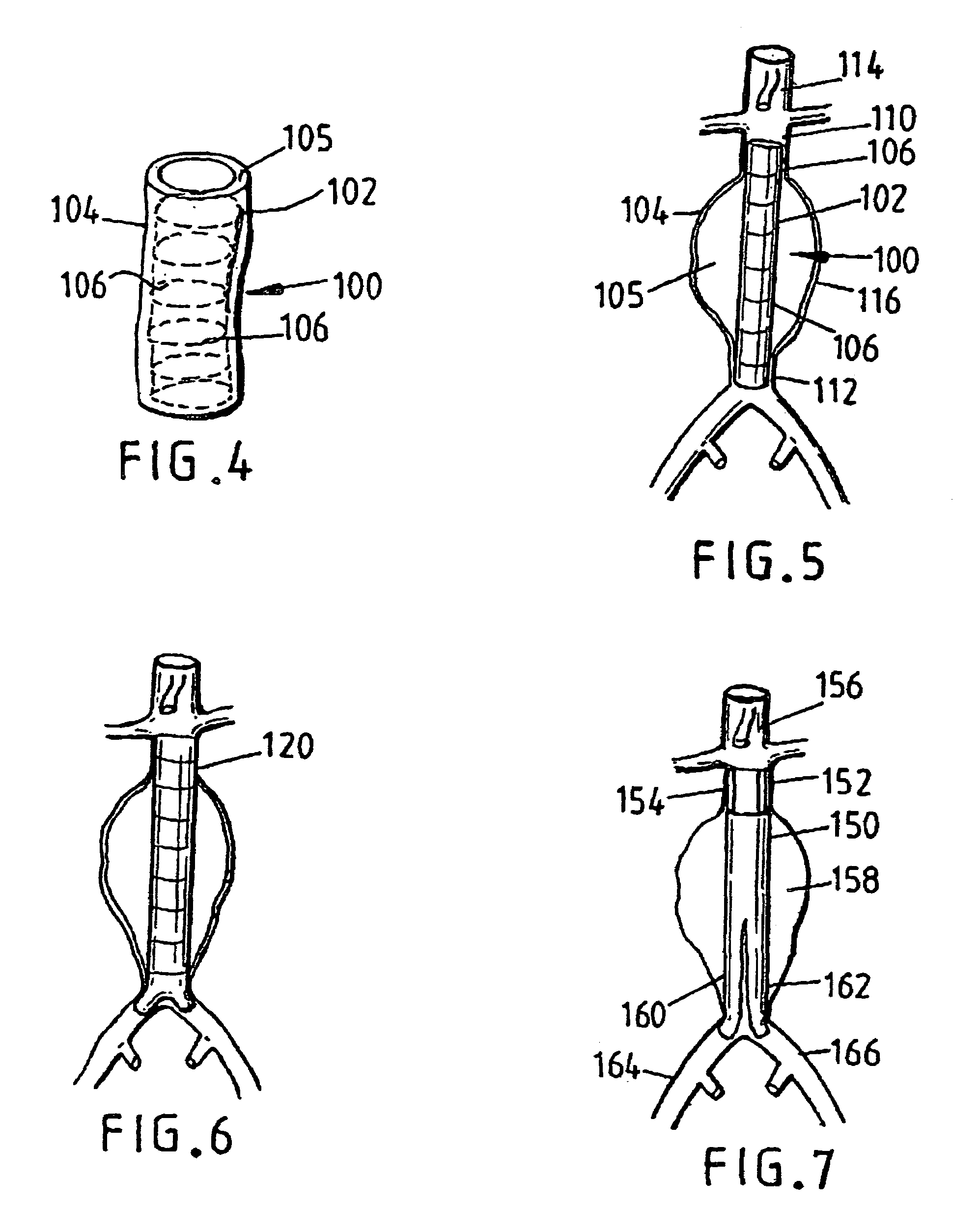 Devices for repairing aneurysms