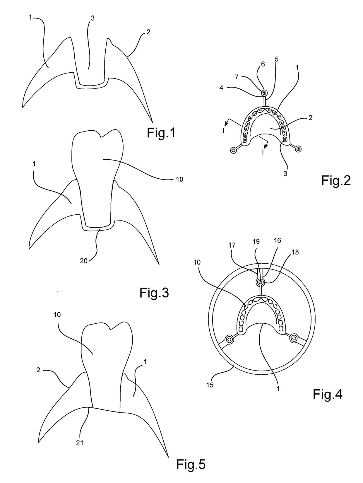 Method for manufacturing a denture