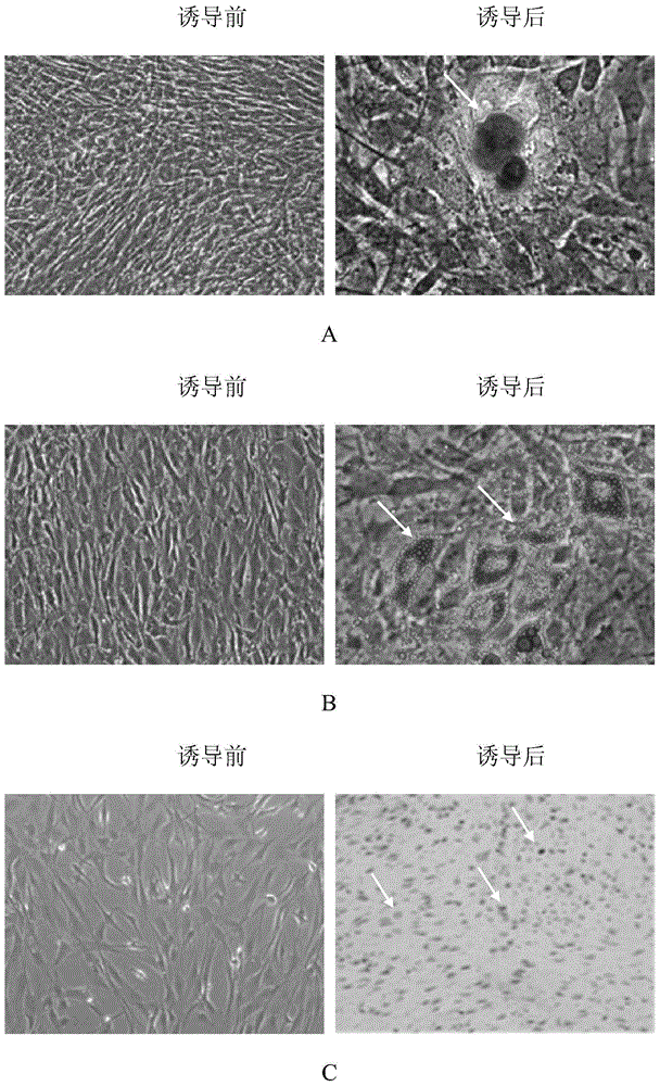 Umbilical cord mesenchymal stem cell injection as well as preparation method and application thereof