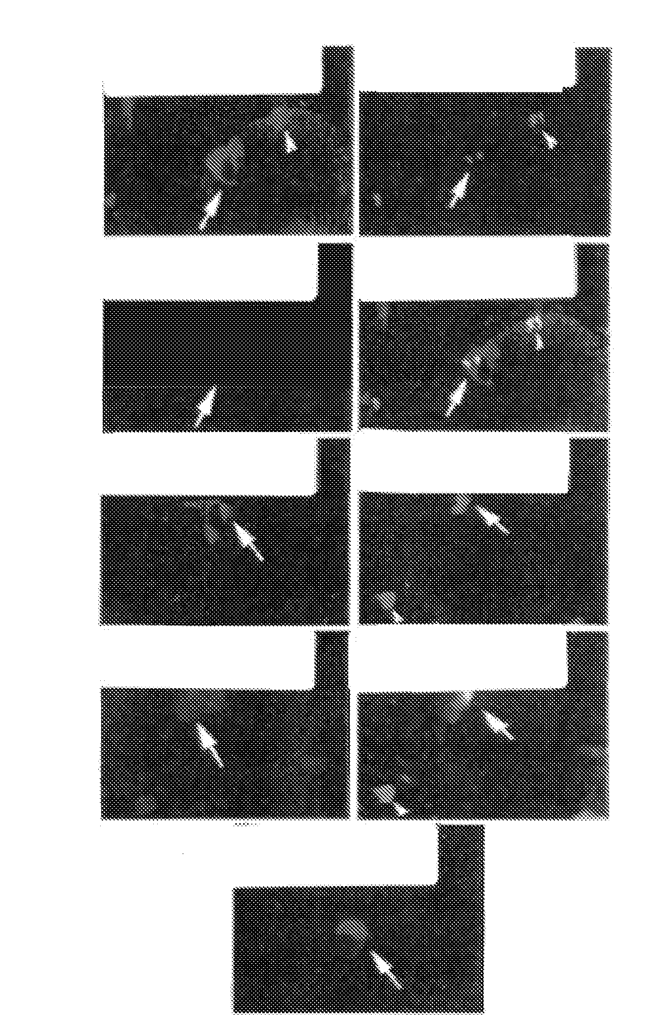Bone Augmentation Utilizing Muscle-Derived Progenitor Compositions, And Treatments Thereof