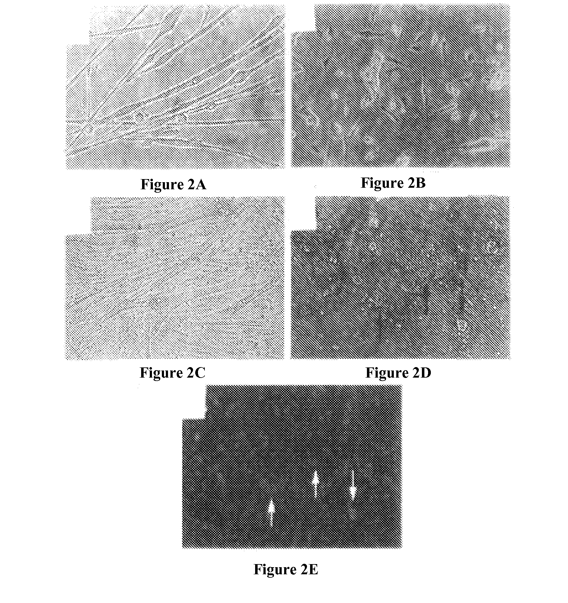 Bone Augmentation Utilizing Muscle-Derived Progenitor Compositions, And Treatments Thereof