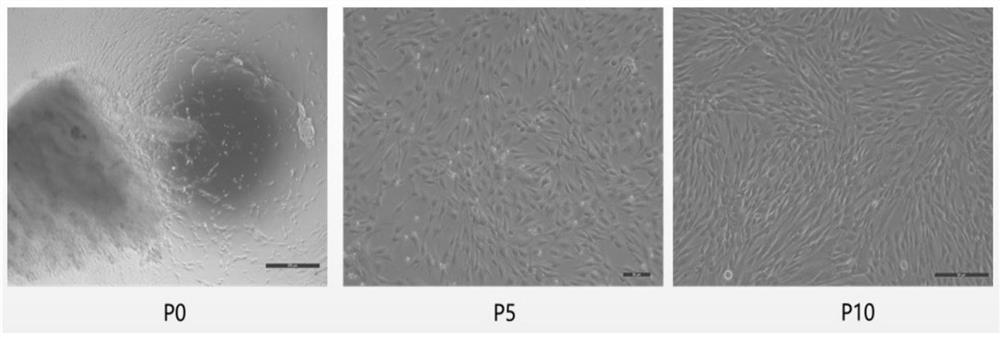 Mesenchymal stem cell serum-free medium and application thereof