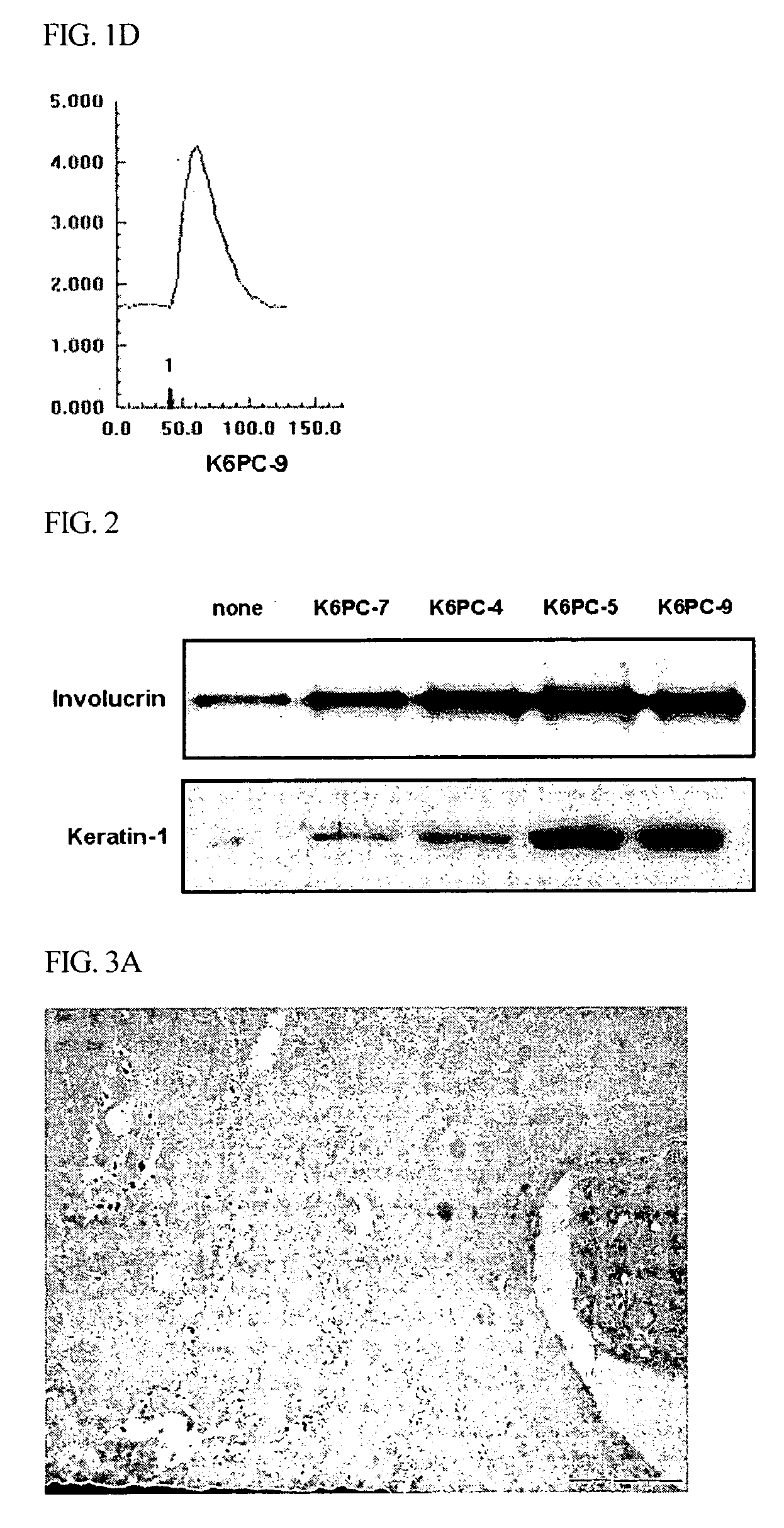 Use of sphingosine kinase activator as skin disease treating agent and method for treating skin diseases using the same