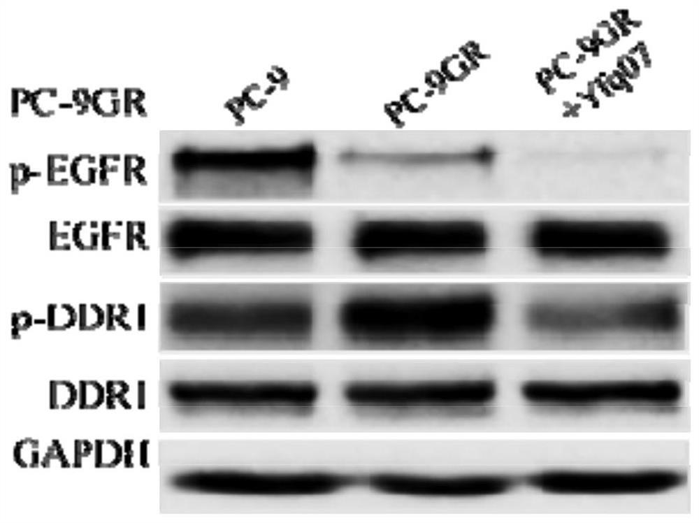 4-amide substituted pyrimidine targeted DDR1 inhibitor as well as preparation and anti-tumor activity application thereof