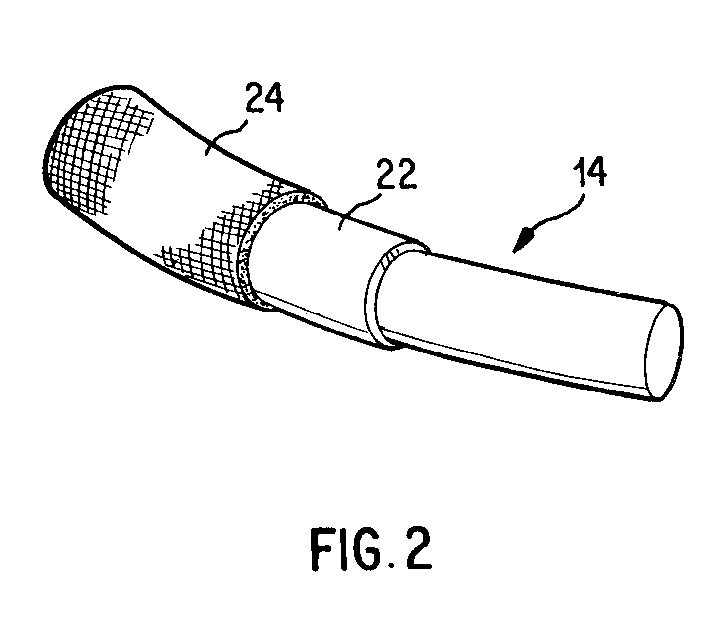 Antimicrobial annuloplasty ring having a biodegradable insert