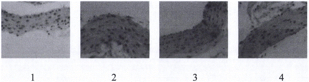 Pharmaceutical composition for treating atherosclerosis and application