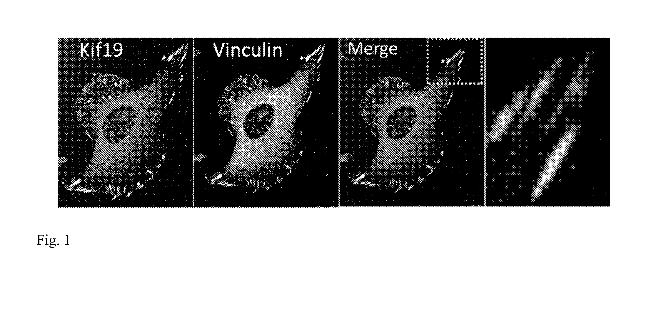 Methods and compositions to inhibit metastasis and to treat fibrosis and to enhance wound healing