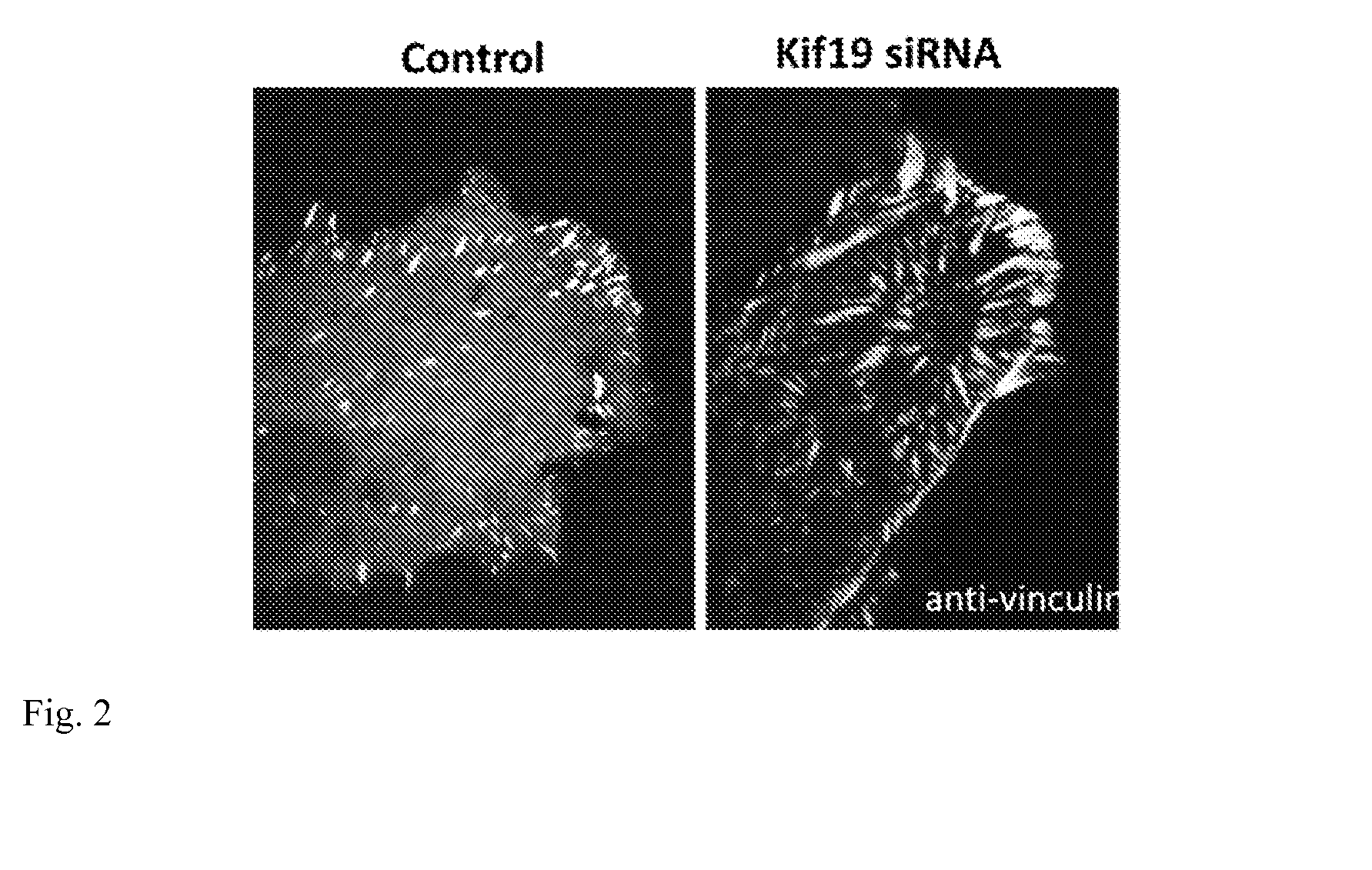 Methods and compositions to inhibit metastasis and to treat fibrosis and to enhance wound healing