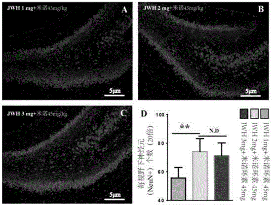 Applications of CB2R (cannabinoid receptor 2) agonist in preparing medicines for treating hypertensive cerebral hemorrhage