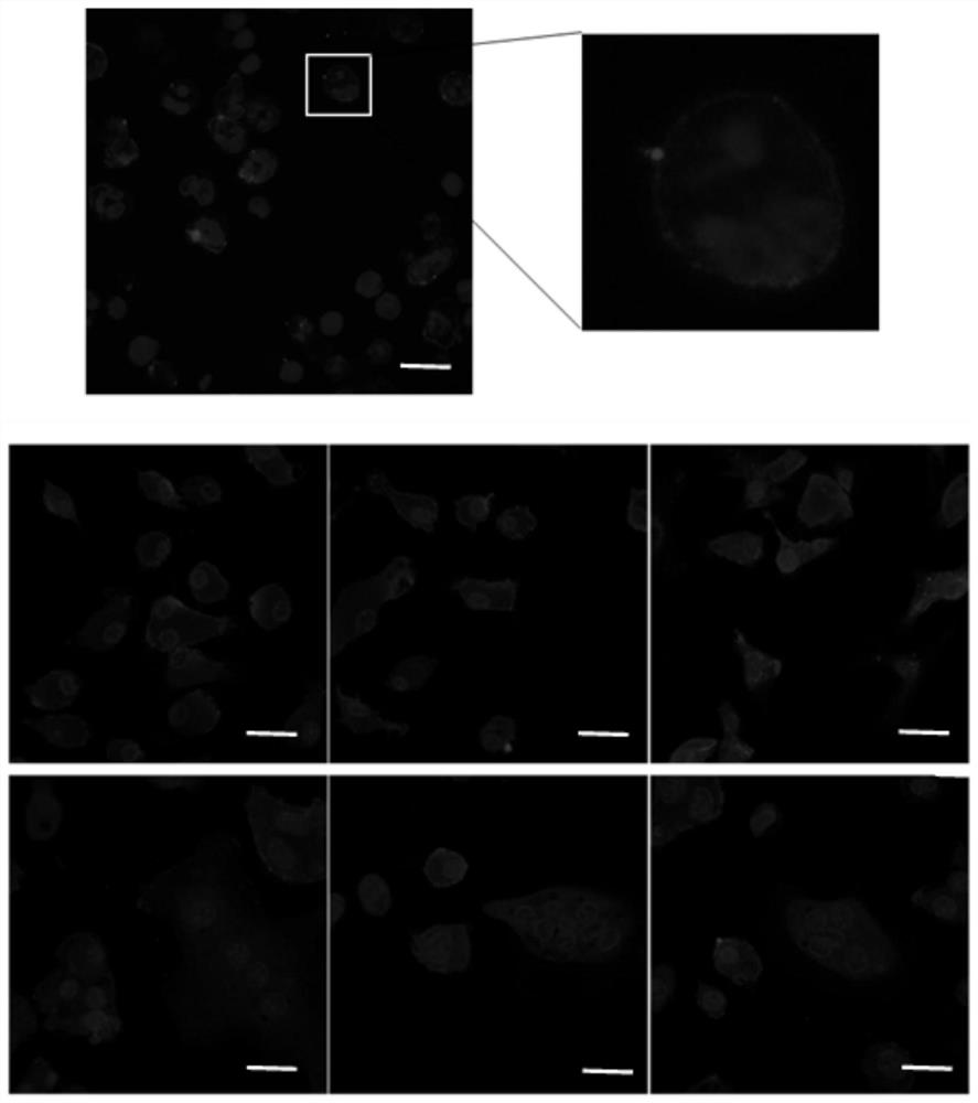 Application of ceramide combined osteoclast surface CD300lf receptor in preparation of medicine for treating periodontitis