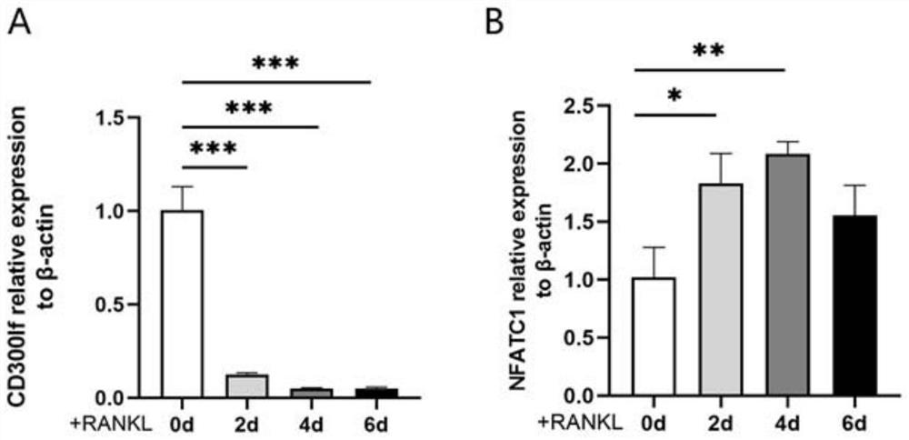 Application of ceramide combined osteoclast surface CD300lf receptor in preparation of medicine for treating periodontitis