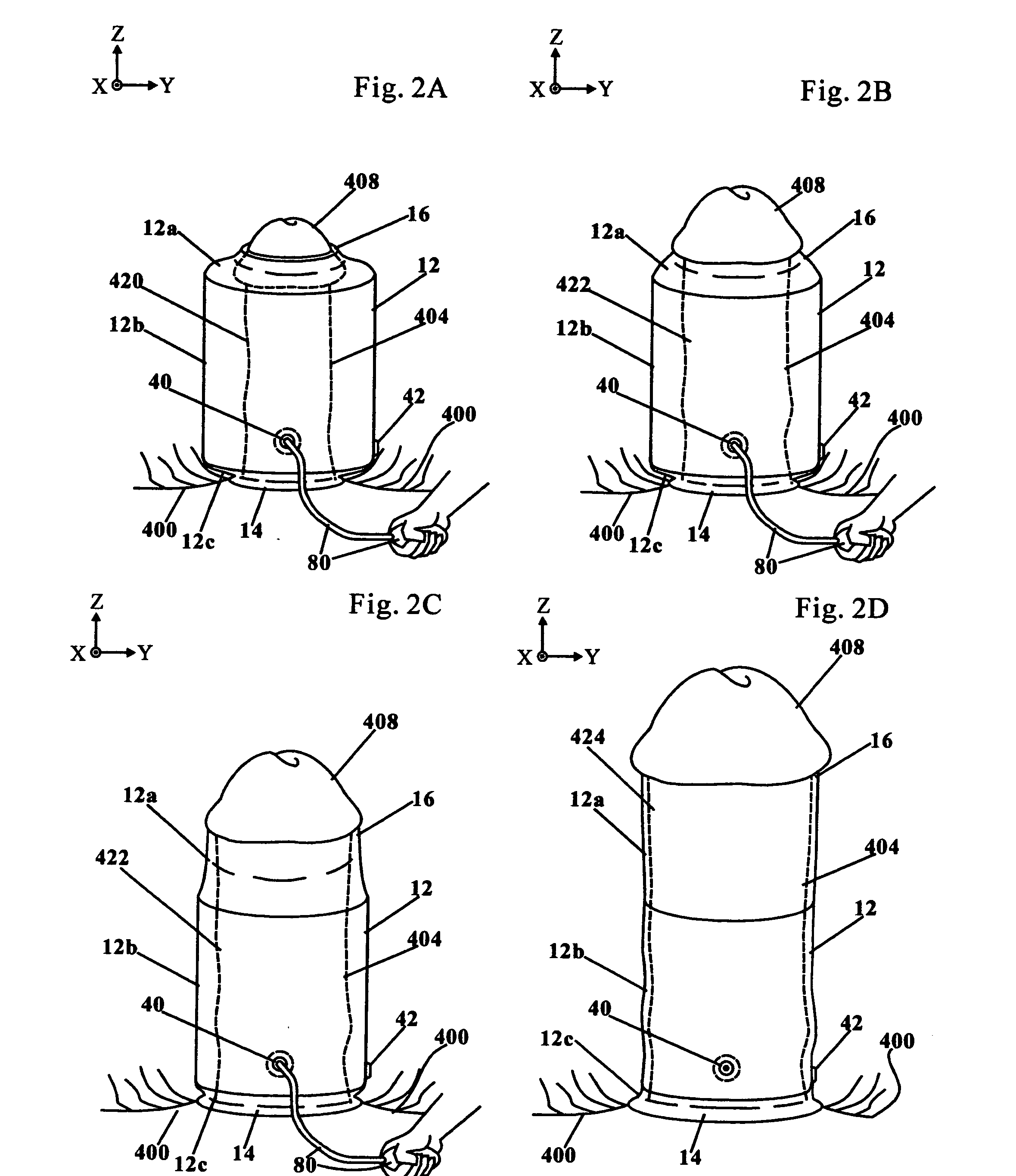 On-genital erection device and system for coital use