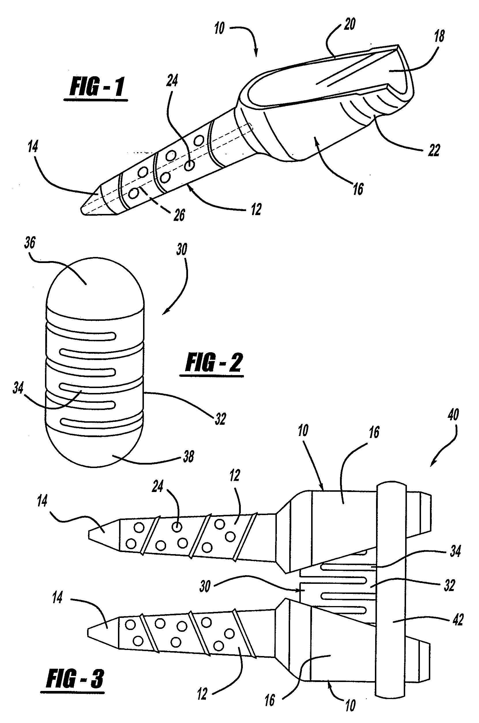 Method for Vertebral Disc Annular Fibrosis Tensioning and Lengthening