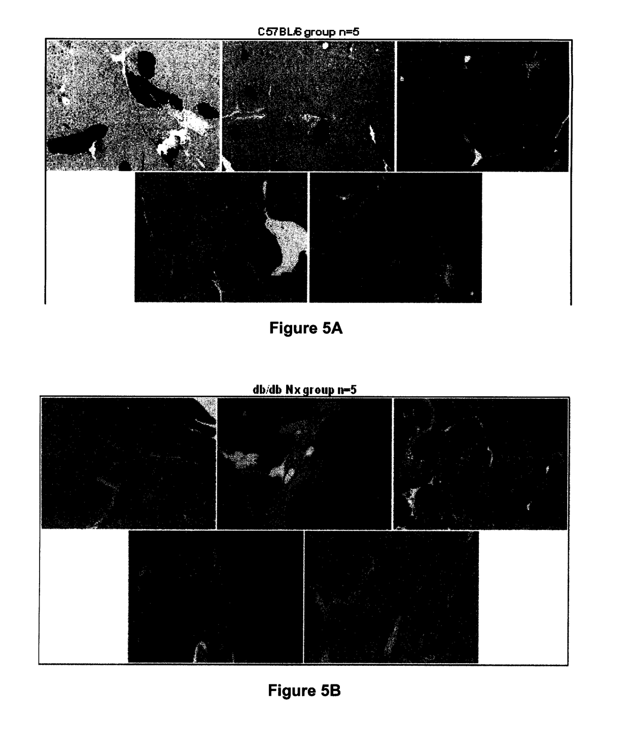 Substituted Aromatic Compounds and Pharmaceutical Compositions For The Prevention And Treatment Of Diabetes