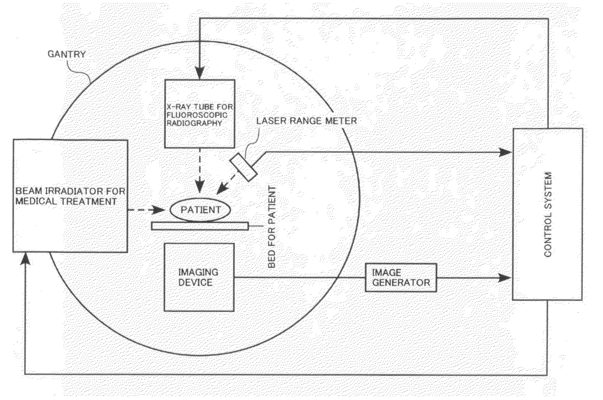 Radiation treatment system