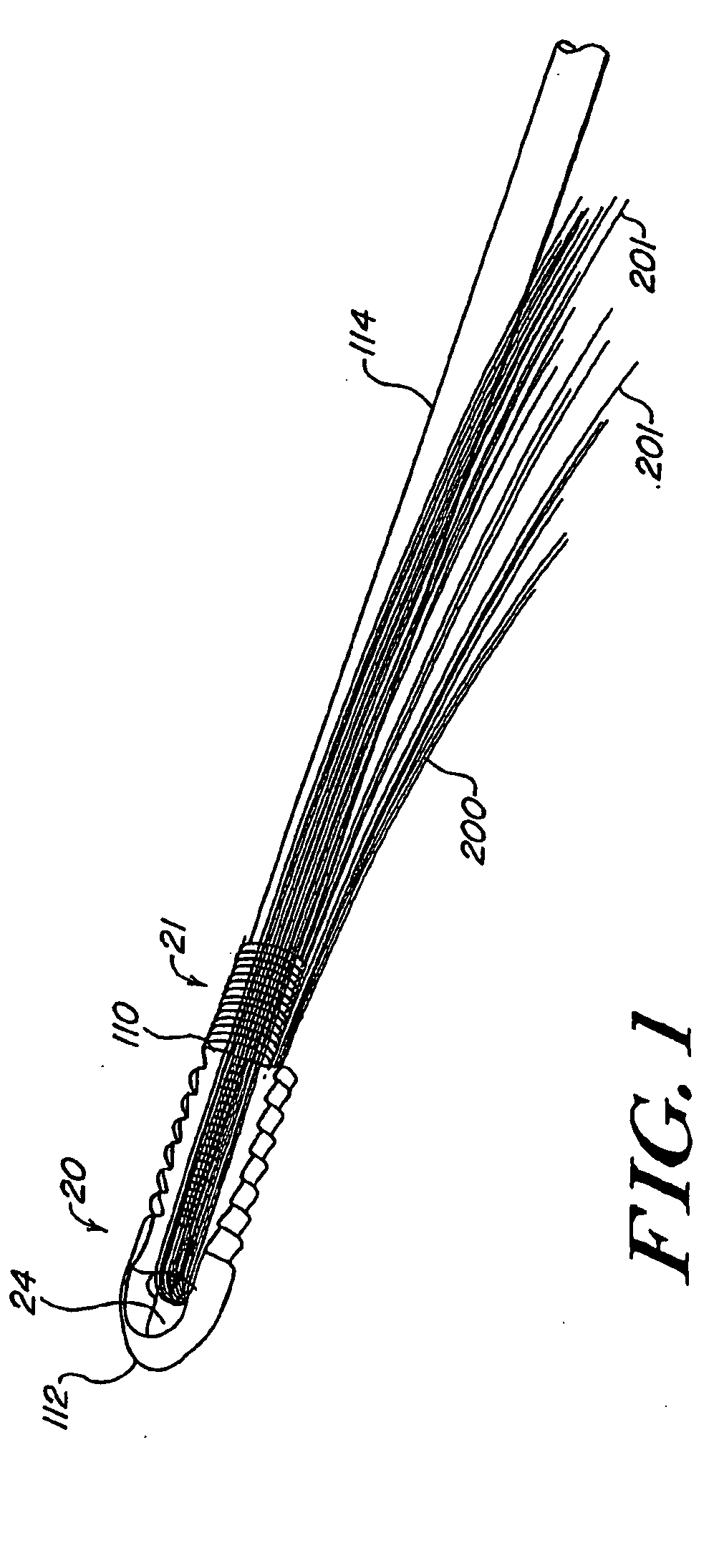 Expanding ligament graft fixation system and method