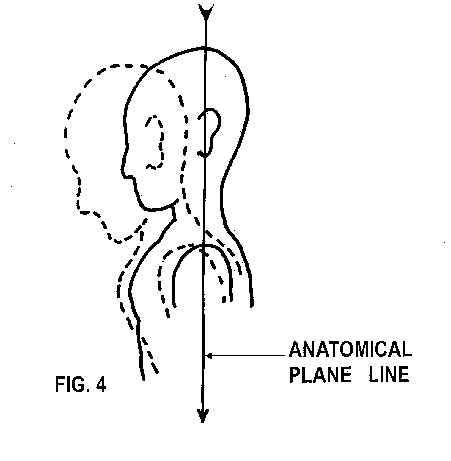 Method and apparatus for correcting head and shoulder posture