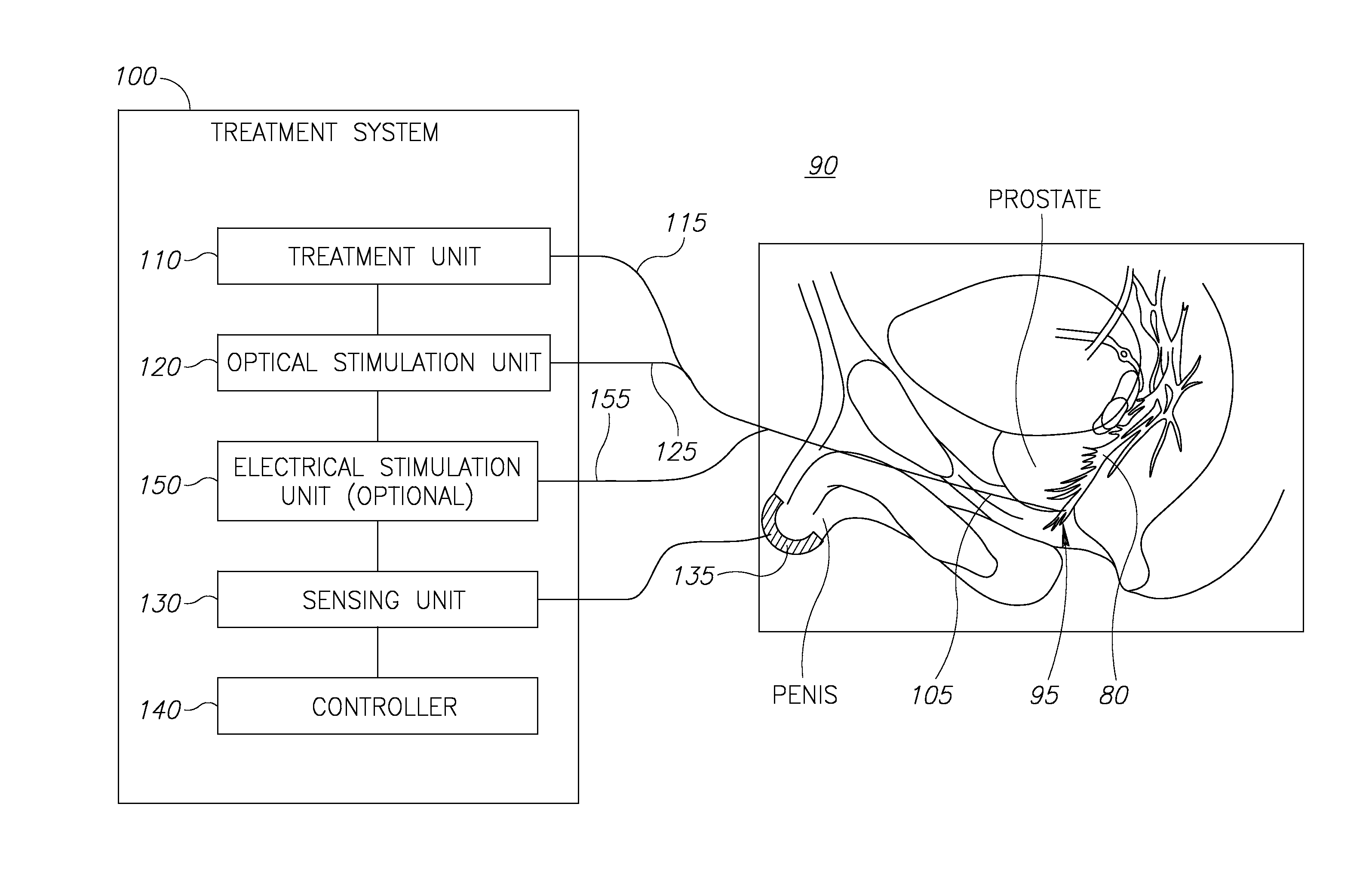 Nerve sparing treatment systems and methods