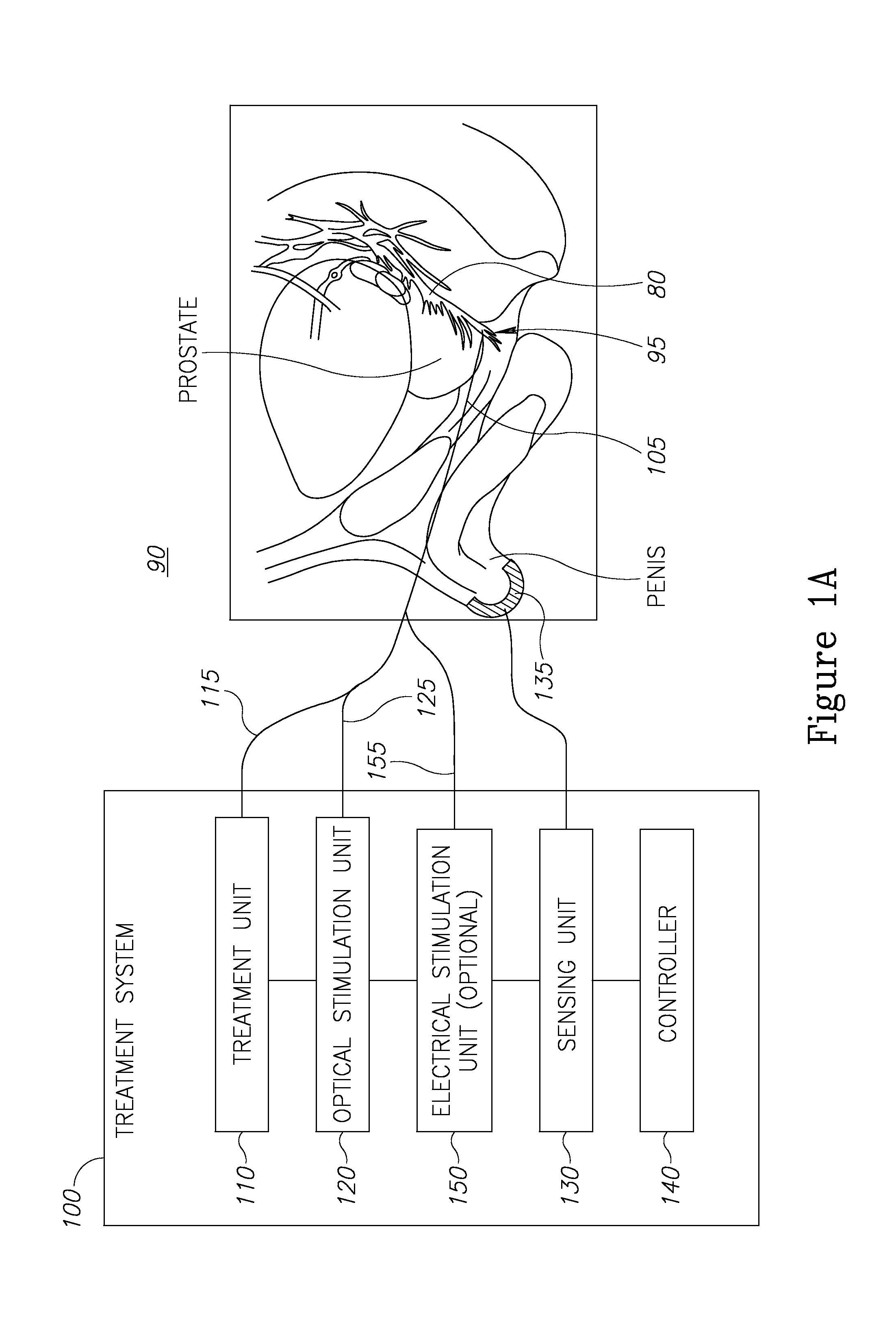 Nerve sparing treatment systems and methods