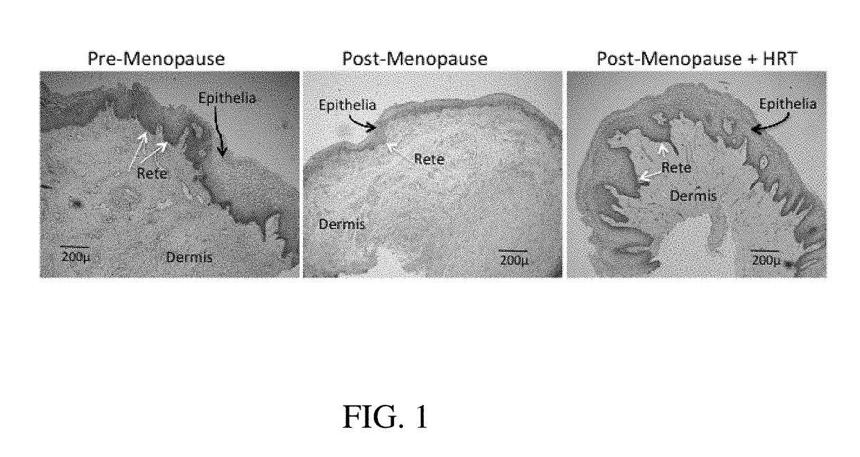 Methods for assessing vaginal atrophy