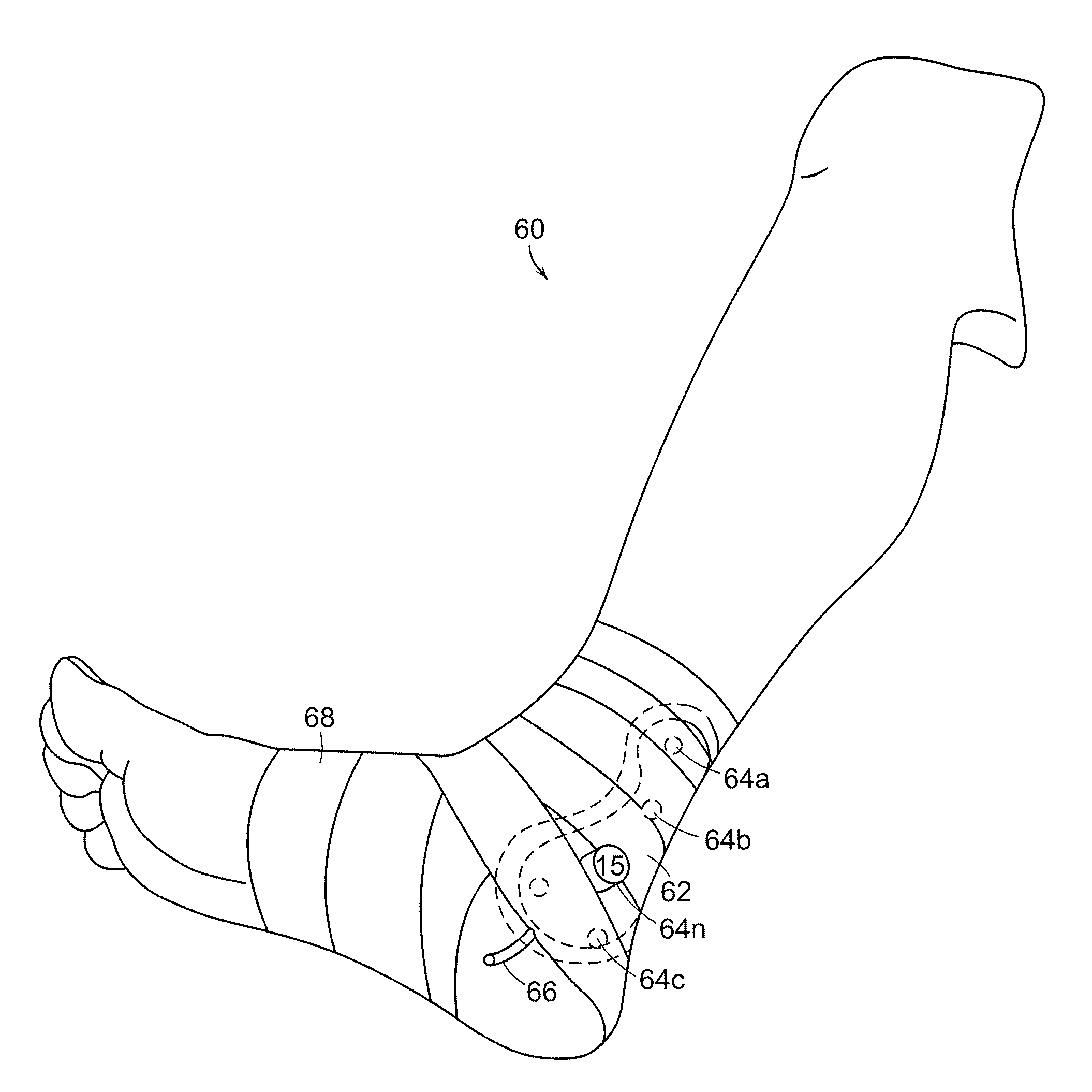 Malleolar pad