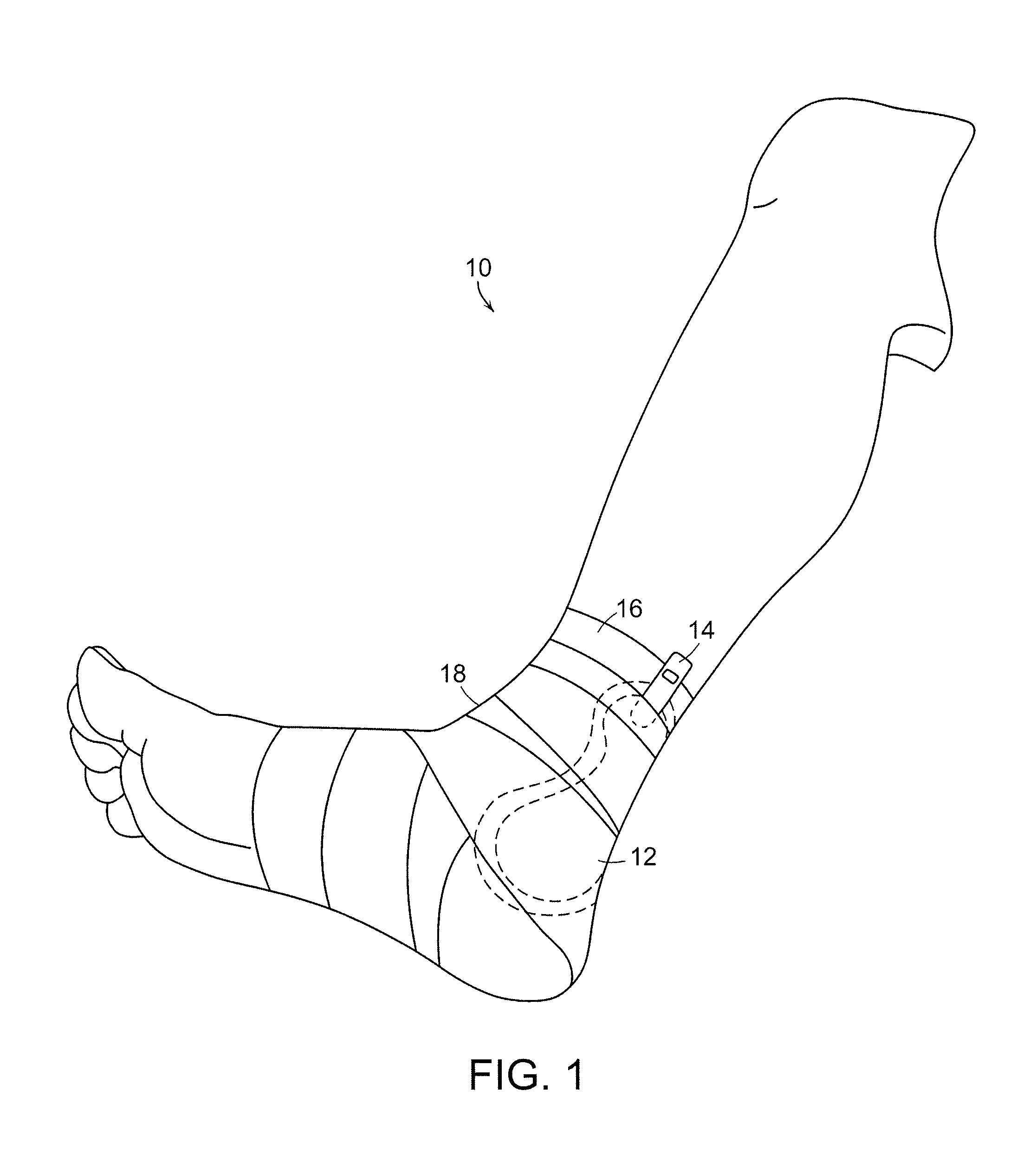 Malleolar pad