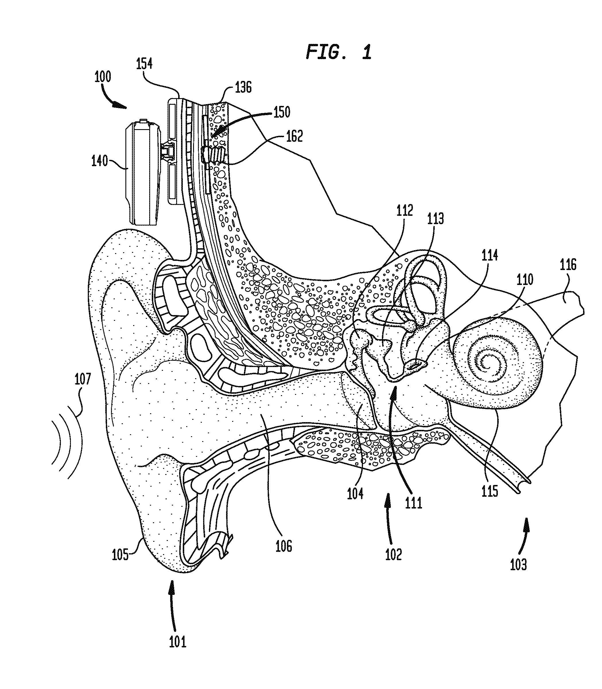 Conformable pad bone conduction device