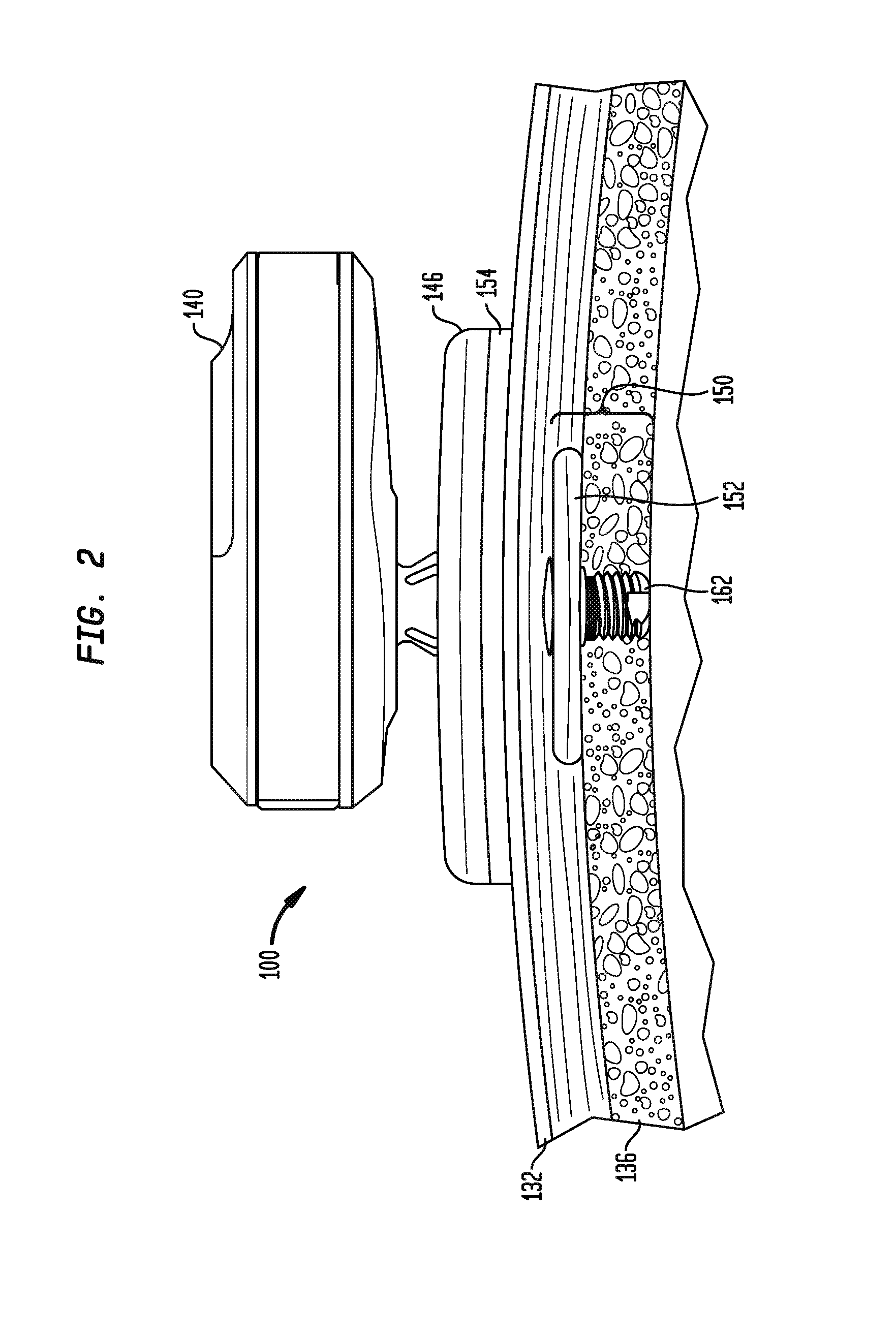 Conformable pad bone conduction device