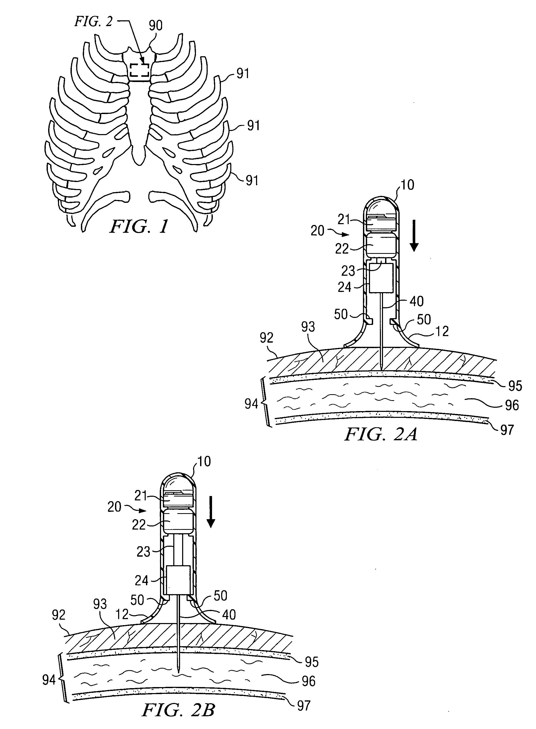 Apparatus and method for accessing the bone marrow