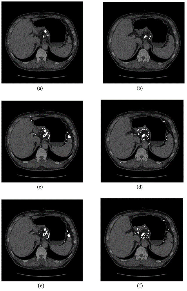 System and method for detecting lymph nodes in gastric CT images based on shape and ellipse fitting