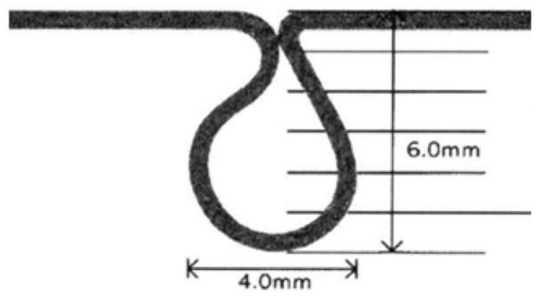 Device and method for assisting invisible orthodontic treatment of mesial mobile molars